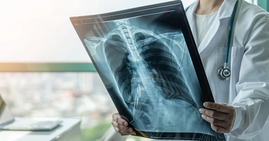 carcinoma scan doctor carcinoma scan doctor