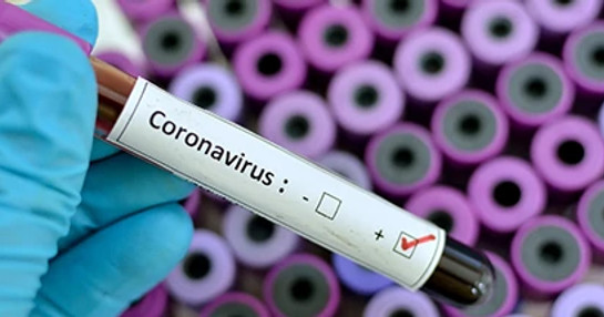 Covid-19-blogs_540x215