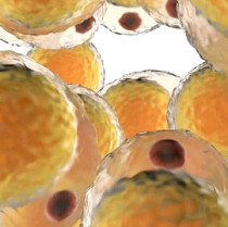 Diabesity_obesity_diabetes_blog thumbnail.jpg