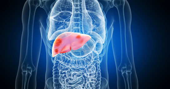 GettyImages_medical imaging_liver close up_1220617737