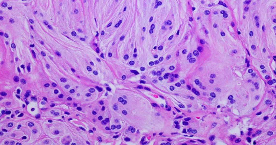 Histopathology-Subpage-Banner-(1)