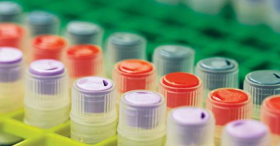 Laboratory samples Laboratory samples