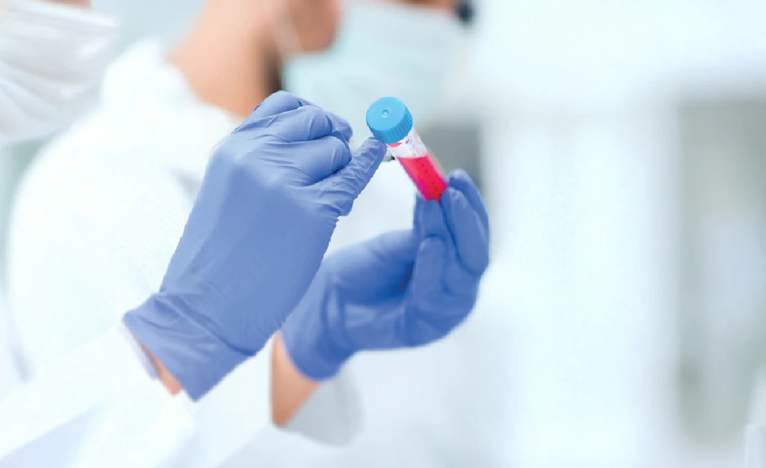 lab test tube sample lab test tube sample
