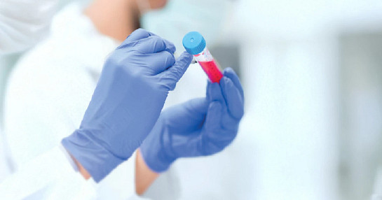 lab test tube sample lab test tube sample