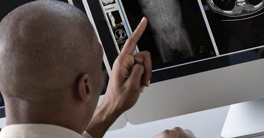 Medical imaging_close up of man looking at scan on monitor Medical imaging_close up of man looking at scan on monitor