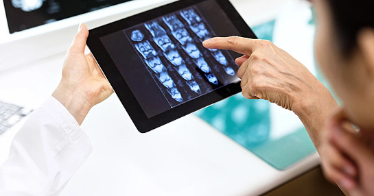 doctor tablet scan multiple myloema doctor tablet scan multiple myloema