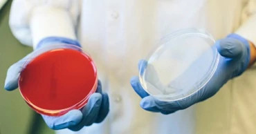 uuid_79e71011-3994-45b7-aca0-4d3fc6f7a2a5_open-petri-dish